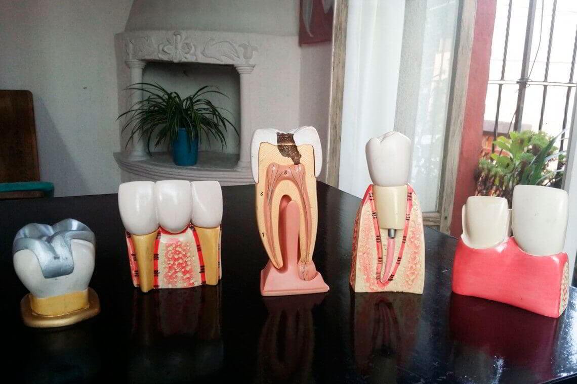 dentista en sanmigueldeallende